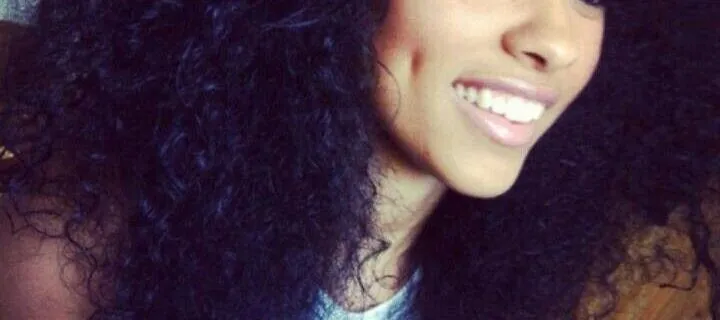 What are dimples? What are dimples?